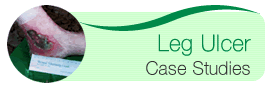 Leg Ulcer Case Studies