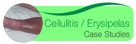 Cellulitis / Erysipelas Case Studies